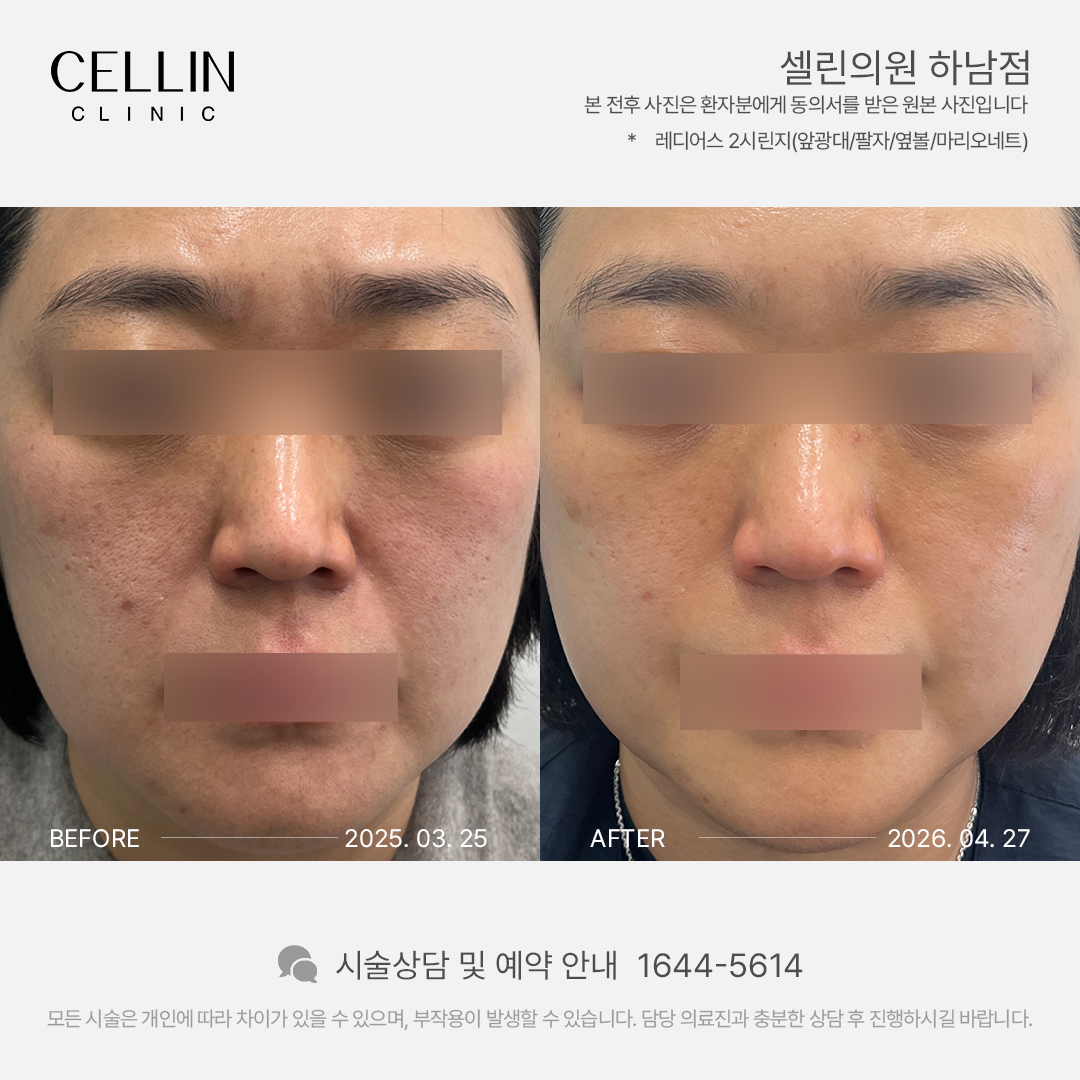랜딩이미지