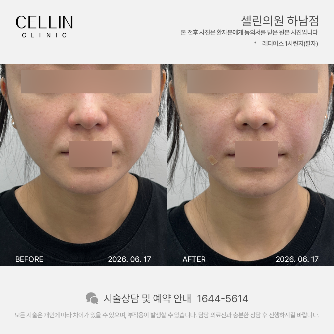 랜딩이미지