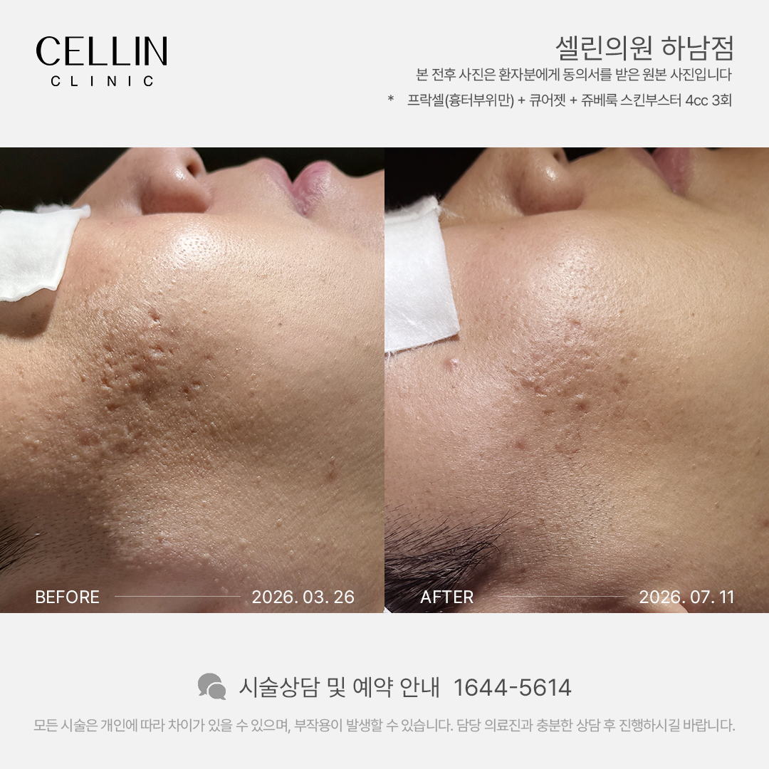 랜딩이미지