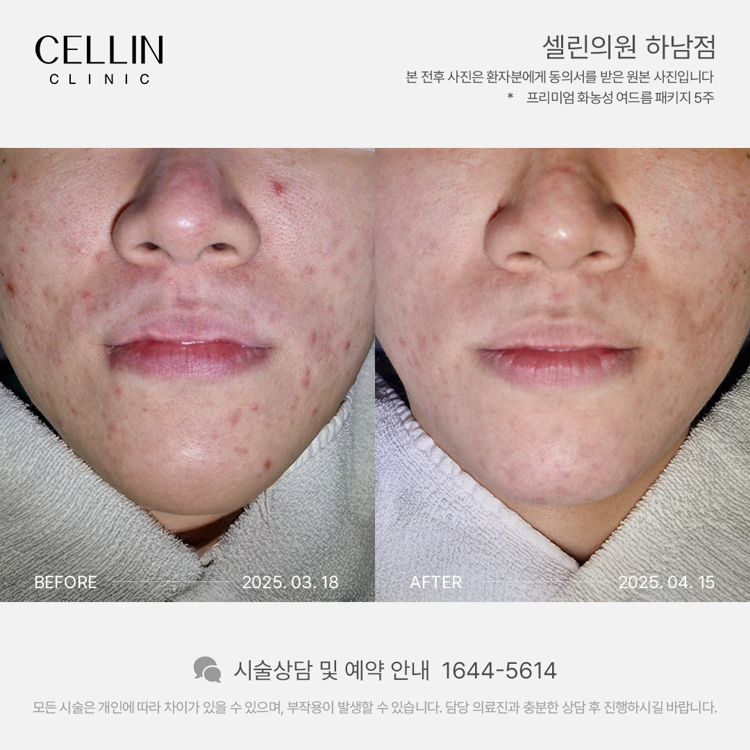 랜딩이미지