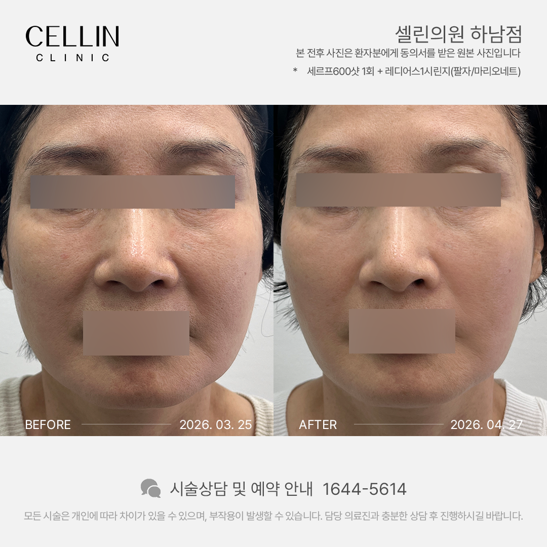 랜딩이미지